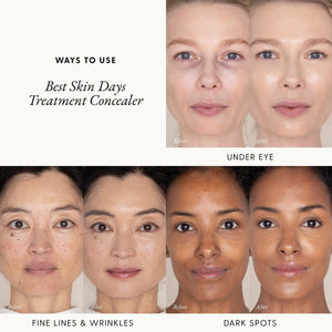 Best Skin Days™ Treatment Concealer