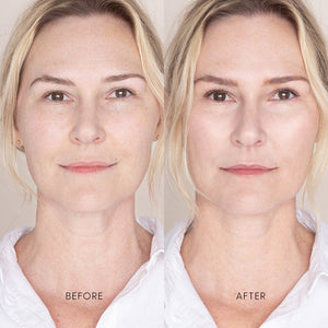 Best Skin Days SPF 30
